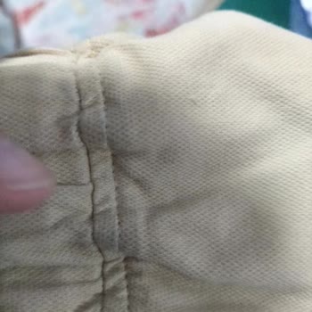 Lekeli Ürün Gönderildi, İade Talebim Karşılanmıyor