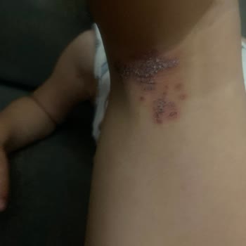 Crystal Waterworld Otel'de Ateş ve El-Ayak Sendromu Belirtileri Başladı