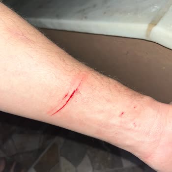 Kurulum Sırasında Patlayan Duşakabin Camı Hayati Tehlike Yarattı