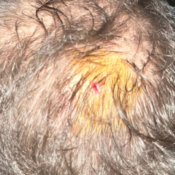 Kurulum Sırasında Patlayan Duşakabin Camı Hayati Tehlike Yarattı