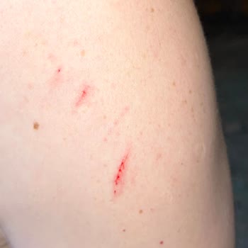 Kurulum Sırasında Patlayan Duşakabin Camı Hayati Tehlike Yarattı