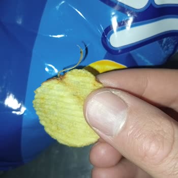 Cipso Cipsinden Yabancı Cisim Şoku!