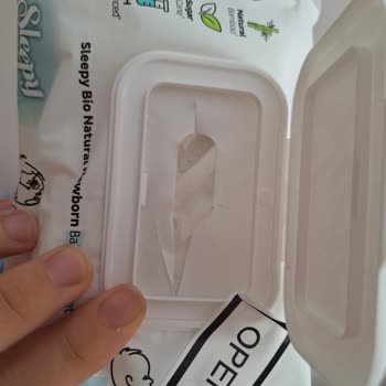 Küflü Islak Mendil Şoku: Para İadesi Ve Özür Bekliyorum