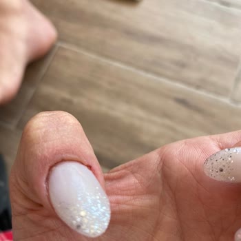 Protez Tırnak Sonrası Yaralar Ve Mağduriyet: Ücret İadesi Talebim Var