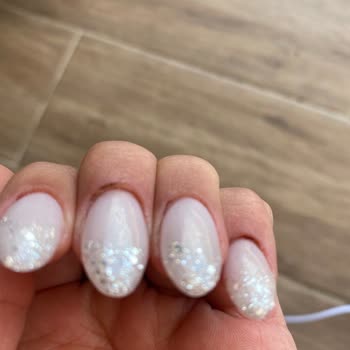 Protez Tırnak Sonrası Yaralar Ve Mağduriyet: Ücret İadesi Talebim Var