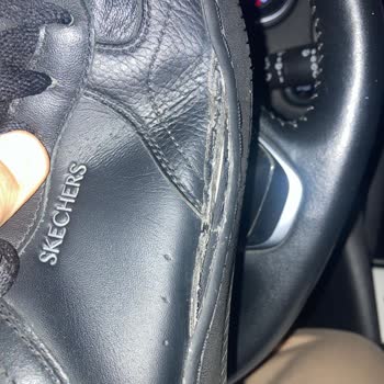 Skechers Ayakkabıda Kısa Sürede Açılma Ve Garanti Reddi Hayal Kırıklığı