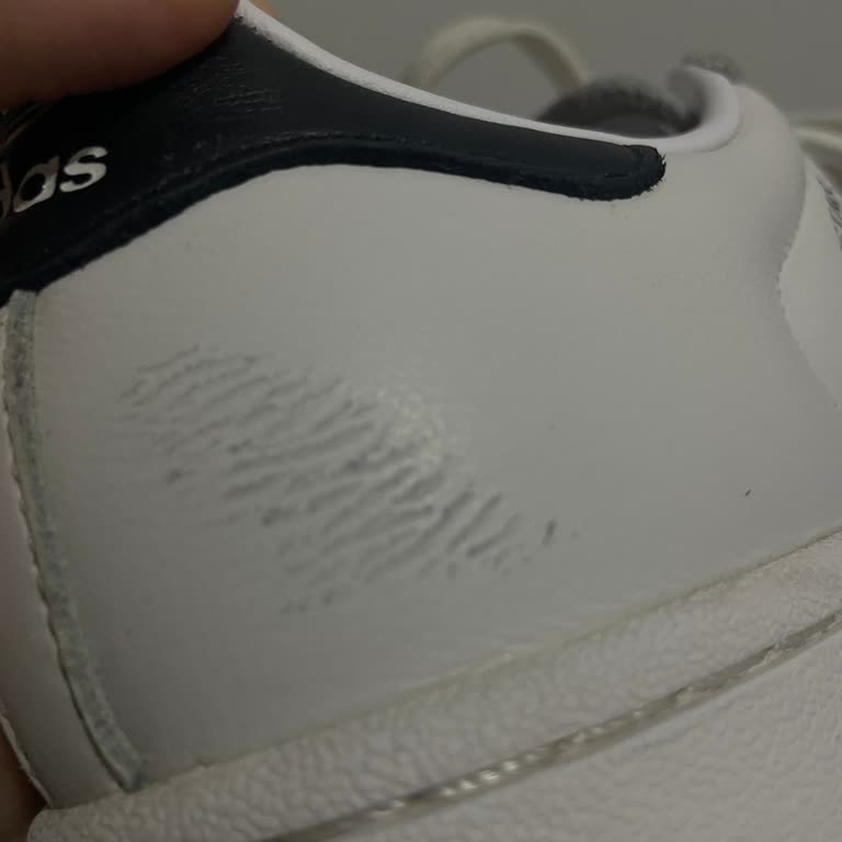 Adidas Superstar Ayakkabıda Topuk Çatlaması Ve Garanti Reddi