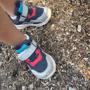 Bir Ayda Deforme Olan Çocuk Ayakkabısına Kullanıcı Hatası Denmesi Mağduriyetim