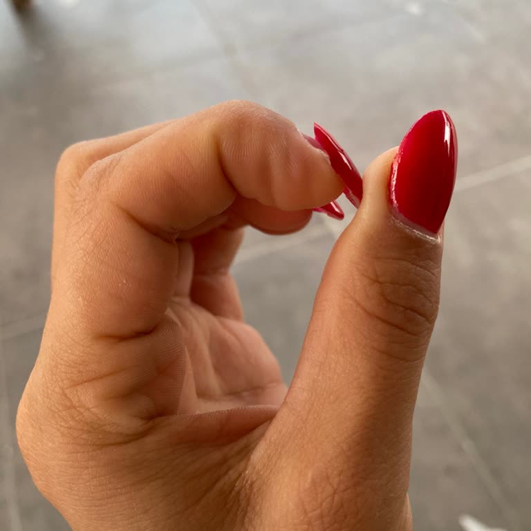 Protez Tırnaklar 5 Günde Çıktı Çalışanlar İlgisiz Ve Kaba Davrandı