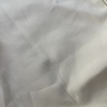 Kusurlu Elbiseye İade Reddi Ve Eksik Bilgilendirme Mağduriyeti