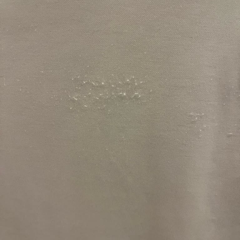 Lacoste Elbisede İlk Kullanımda Tüylenme Ve Renk Değişikliği, Müşteri Hizmetlerinden Geri Dönüş Alınamıyor