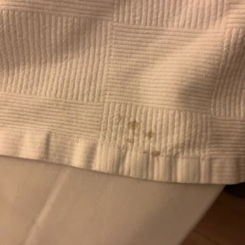 Otel Odası Hijyen Ve Koşulları Beklentilerin Çok Altında, Ücret İadesi İstiyorum