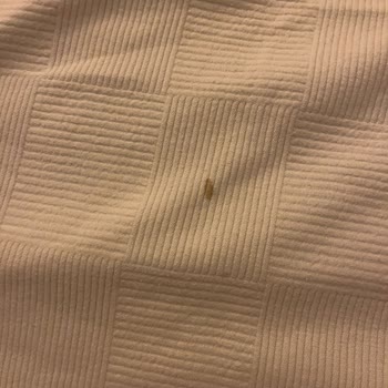 Otel Odası Hijyen Ve Koşulları Beklentilerin Çok Altında, Ücret İadesi İstiyorum