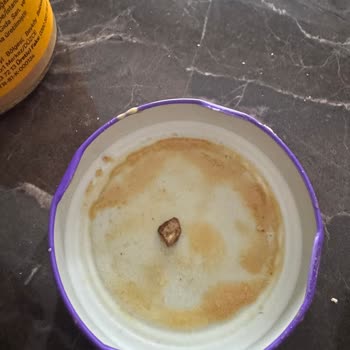 Fıstık Ezmesinden Çıkan Taş Dişimi Kırdı, Mağduriyet Yaşadım