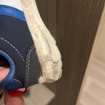 Yeni Yürüyen Bebeğimin Ayakkabısı İki Ayda Döküldü Firma İlgisiz Kaldı