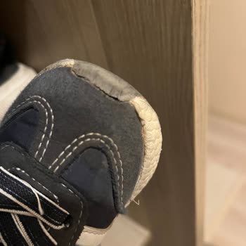 Yeni Yürüyen Bebeğimin Ayakkabısı İki Ayda Döküldü Firma İlgisiz Kaldı