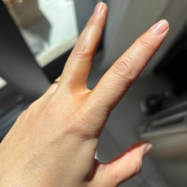 Bronzlaştırıcı İksir Cildimde Kalıcı Koyu Lekeler Bıraktı Çözüm Bekliyorum