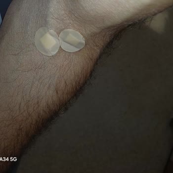 Çamlıca Medipol Hastanesi'nde İlgisiz Ve Kaba Hizmet, Yüksek Ücret Karşılığında Hayal Kırıklığı