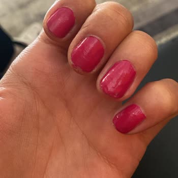 Protez Tırnak İşlemi Sonrası Kötü Sonuç Ve Ücret İadesi Talebi