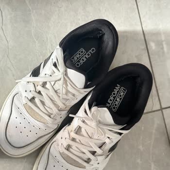 2 Ayda Delinen Adidas Ayakkabı İçin Amazon'dan Garanti Desteği Alamadım