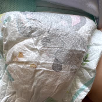 Prima 3 Numara Bebek Bezinde Islaklık Göstergesi Eksikliği Nedeniyle Mağduriyet