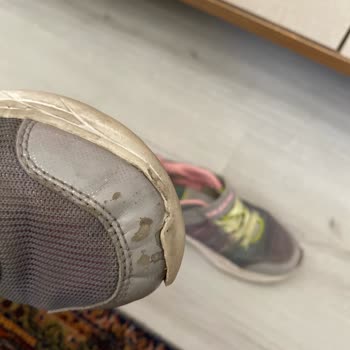 Kısa Sürede Deforme Olan Ayakkabı İçin Garanti Desteği Alamadım