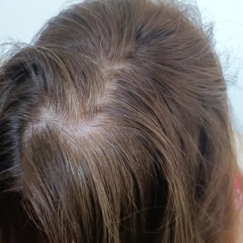 L'Oreal Excellence Intense Saç Boyası Renk Sorunu Ve Beyazları Kapatmama Problemi