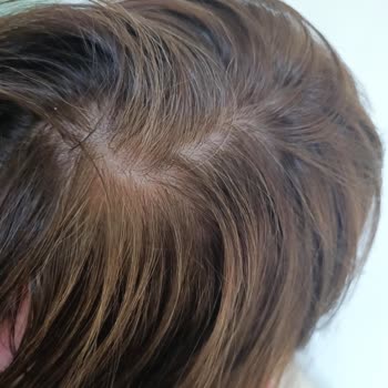 L'Oreal Excellence Intense Saç Boyası Renk Sorunu Ve Beyazları Kapatmama Problemi