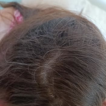 L'Oreal Excellence Intense Saç Boyası Renk Sorunu Ve Beyazları Kapatmama Problemi