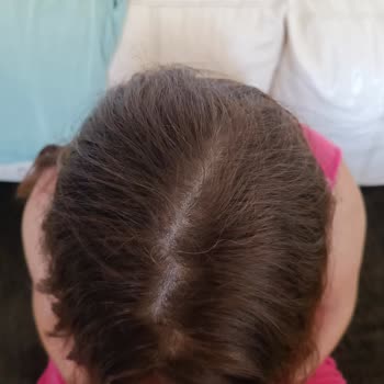 L'Oreal Excellence Intense Saç Boyası Renk Sorunu Ve Beyazları Kapatmama Problemi