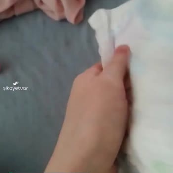 Molfix Bebek Bezi Şikayeti