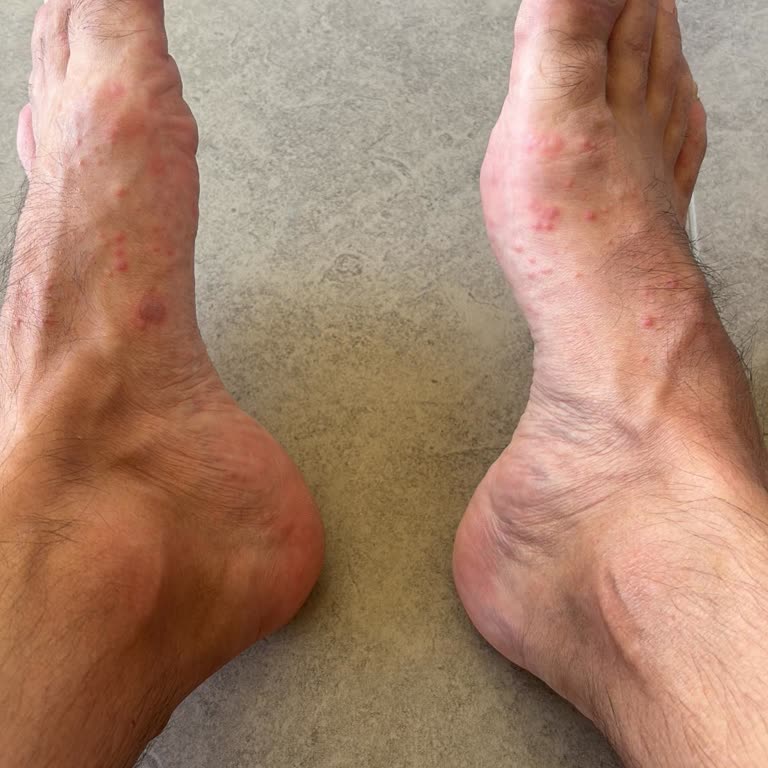 Havuzdaki Hijyen Eksikliği Sağlık Sorunlarına Yol Açtı, Ücret İadesi Talep Ediyorum