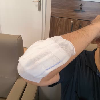 17 Km Farkla Garanti İptali Ve Mağduriyet