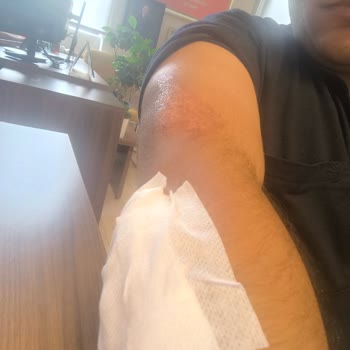 17 Km Farkla Garanti İptali Ve Mağduriyet