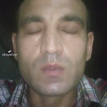 Uyuz Salgını Var Hatay'da Yardım Edin Lütfen!