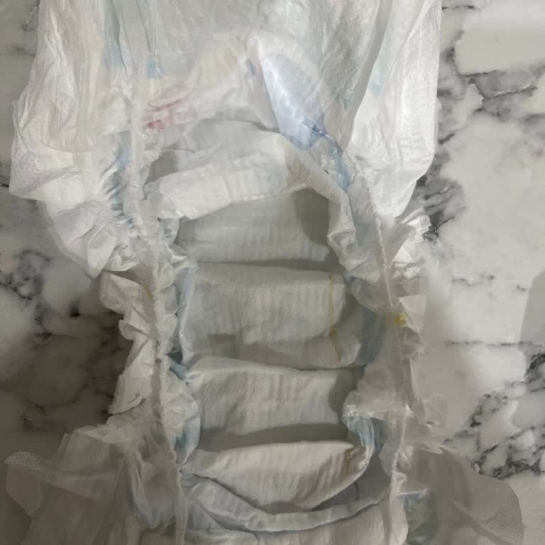 Molfix Bebek Bezinde Pamuksuz Ve Hatalı Ürün Mağduriyeti Yaşadım