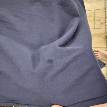 Elbise Çekmesi, Leke Sorunu Ve Ücret İadesinde Gecikme