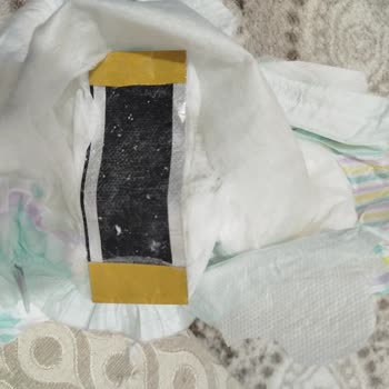 Bebek Bezinde Yabancı Madde Ve Yapıştırma Hatası Mağduriyet Yaşattı