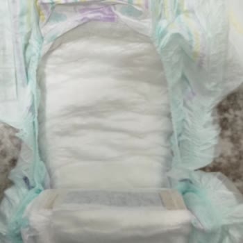 Bebek Bezinde Yabancı Madde Ve Yapıştırma Hatası Mağduriyet Yaşattı