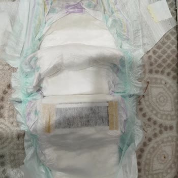 Bebek Bezinde Yabancı Madde Ve Yapıştırma Hatası Mağduriyet Yaşattı