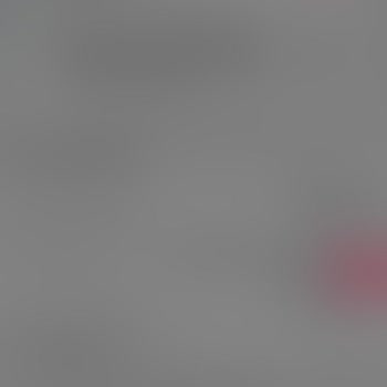 Eksik Ve Hijyen Sorunlu Siparişlere Çözüm Sunulmuyor