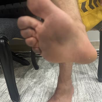 Aldığım Skechers Ayakkabıda Çökme Ve Yaralanma Problemi, Değişim Talebim Reddedildi