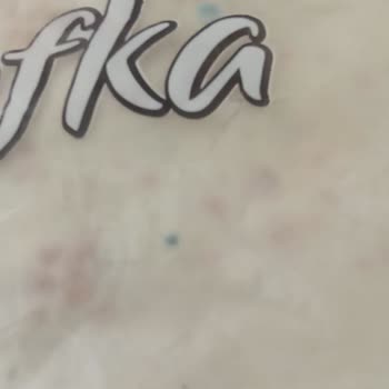 A101 Son Kullanma Tarihi Geçmiş Küflü Yufka Ve Mağazada İade Sorunu