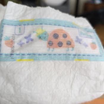 Prima Yenidoğan Bezinde Cilt Tahrişi Ve Yapışma Sorunu