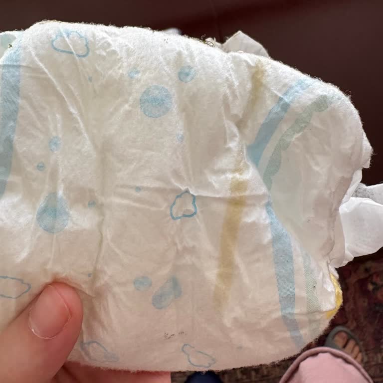 Molfix Bebek Bezinde İdrar Göstergesi Sorunu Ve İade Talebi