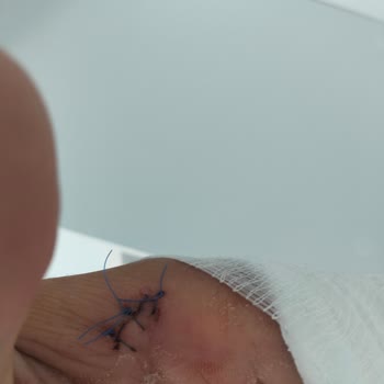 Teslimat Sonrası Patlayan Duşakabin Camı Nedeniyle Yaşanan Sağlık Ve Maddi Mağduriyet