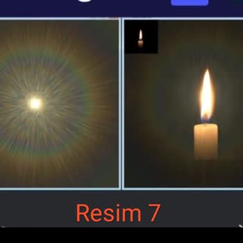 Lasik Ameliyat Sonrası Yaşanan Kalıcı Görme Bozuklukları Ameliyat Gerçeklerinin Söylenmemesi