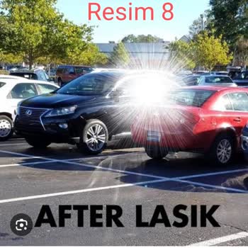 Lasik Ameliyat Sonrası Yaşanan Kalıcı Görme Bozuklukları Ameliyat Gerçeklerinin Söylenmemesi