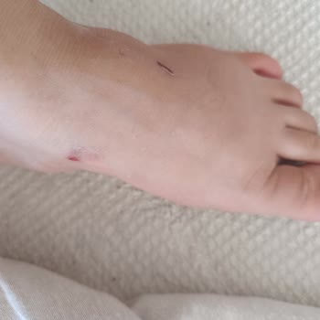 Bambi Ayakkabı İlk Kullanımda Yaralanmaya Sebep Olan Terlik İçin İade Talebi