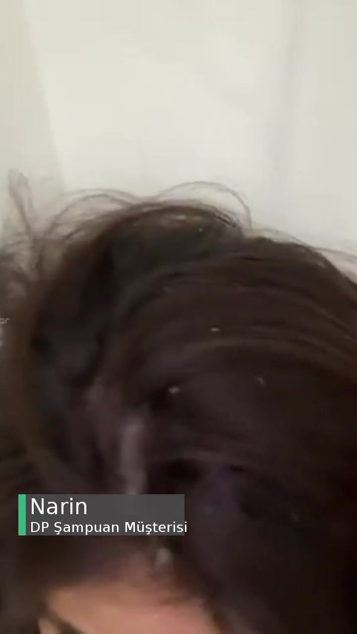 DP Şampuan Kepeklenme Ve Kaşıntı Yaptı! videonun kapak resmi